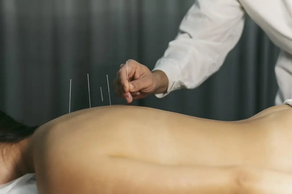 Acupuncturist in Ede